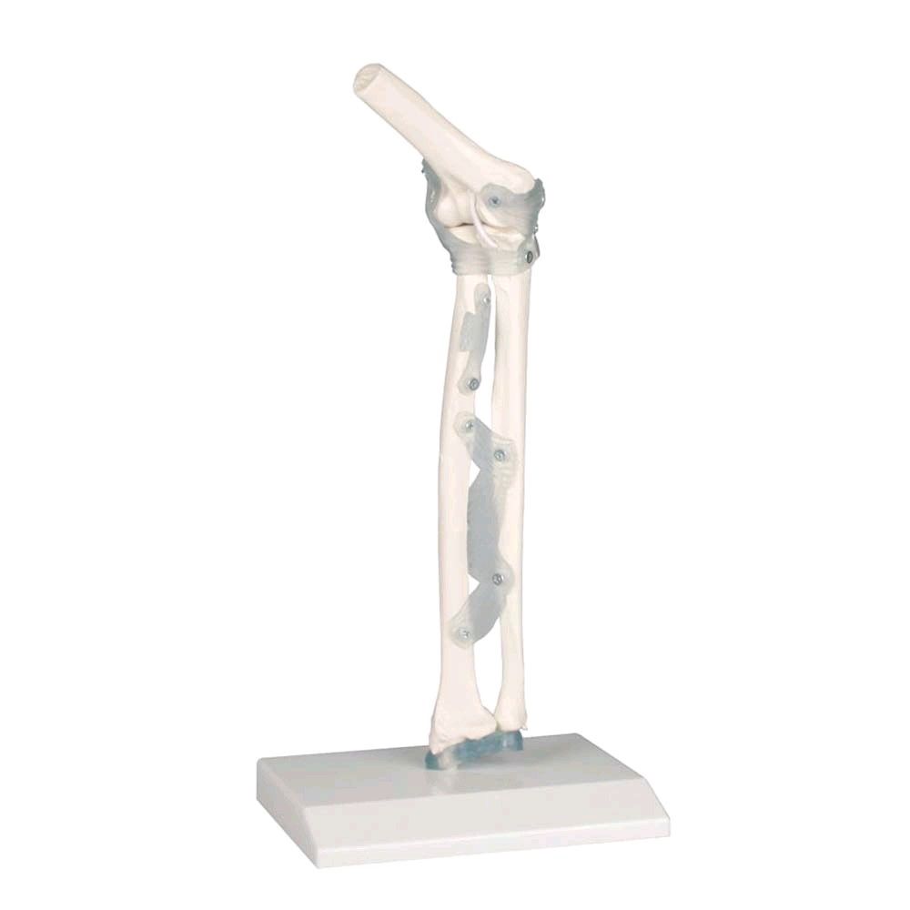 Modell Ellenbogengelenk mit Bändern auf Stativ, anatomische Darstellung am Unterarm