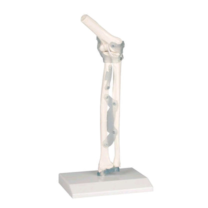 Modell Ellenbogengelenk mit Bändern auf Stativ, anatomische Darstellung am Unterarm