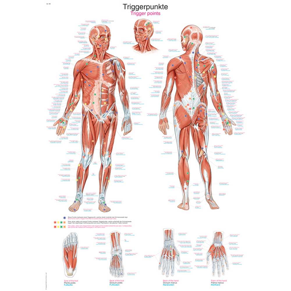 Erler Zimmer anatomische Lehrtafel: Triggerpunkte am Körper, Vorder- und Rückansicht