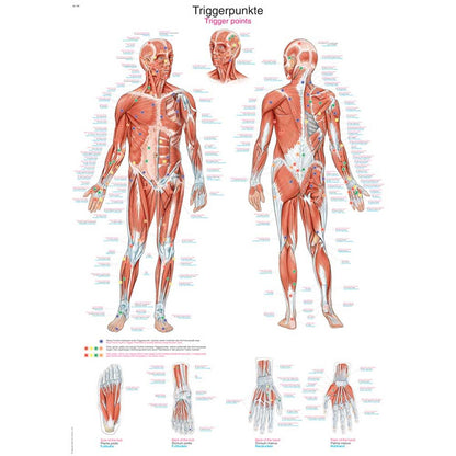 Erler Zimmer anatomische Lehrtafel: Triggerpunkte am Körper, Vorder- und Rückansicht
