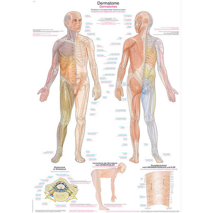 Anatomische Lehrtafel Dermatomkarte mit Markierungen an Rumpf und Armen