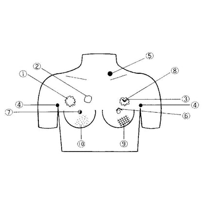 Brustkrebsvorsorge-Tastmodell, schematische Vorderansicht mit nummerierten Markierungen
