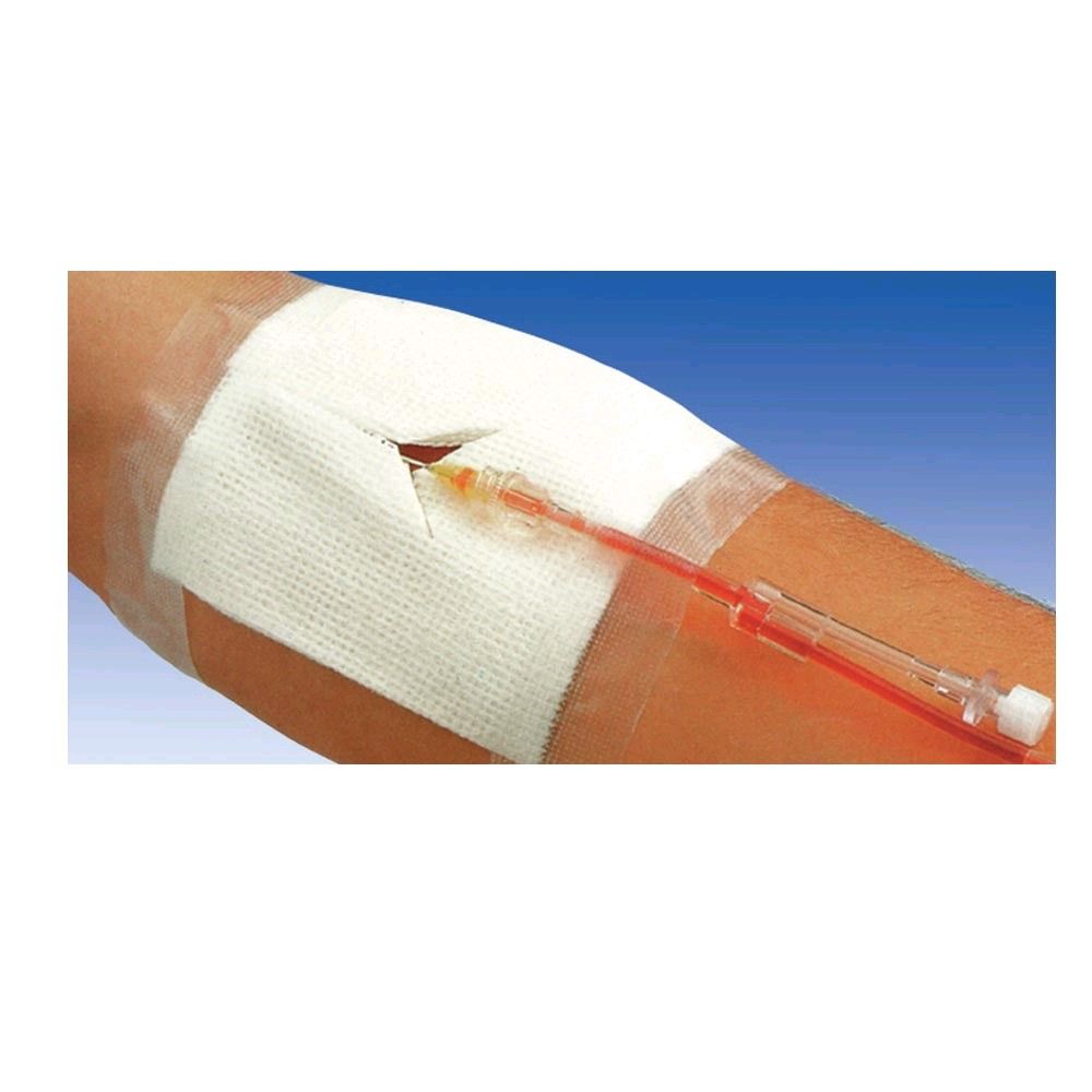 Schlitzkompresse mit Medicomp® Drain am Arm, steril wirkender Wundverband