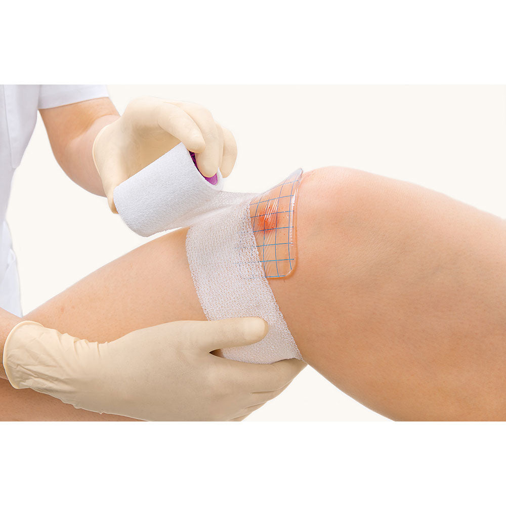 Hydrogelverband HydroTac transparent auf Haut, Verband mit blauem Rasterträger